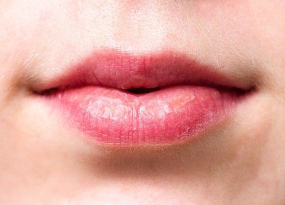Wrinkles Above the Lips: The Best Treatments & Prevention